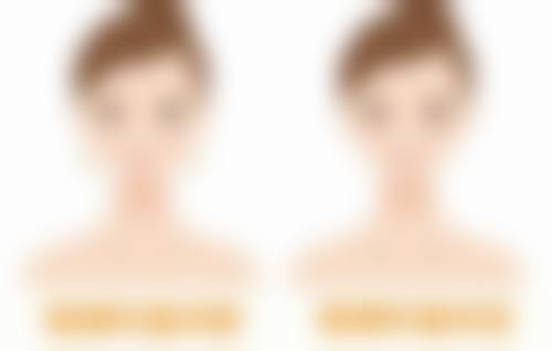 韩国winners整形外科医院正规吗?