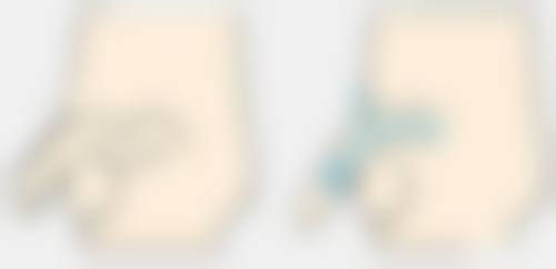 对于浅至中度的艾灸疤痕有什么修复方案呢?