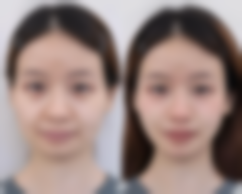 乌鲁木齐王焕梅整形医院口碑评价怎么样？