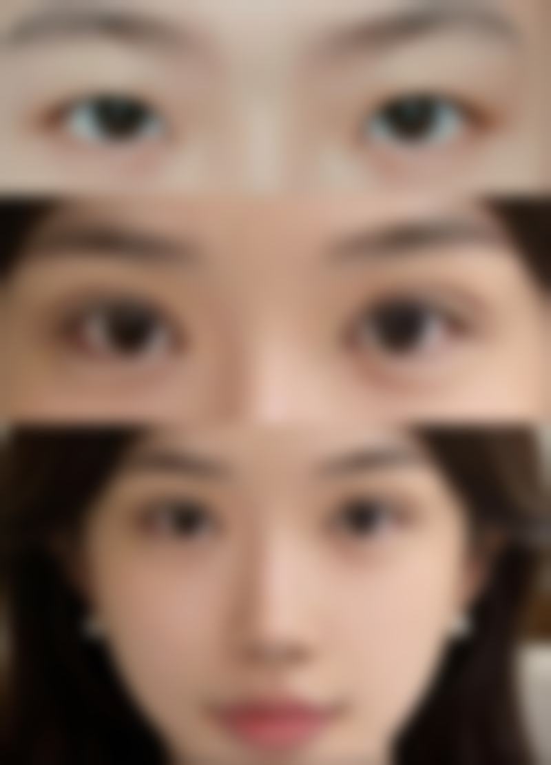 熟龄肌结构性眼袋适合用什么高端修护型产品?