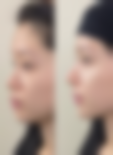 肇庆颜究院整形医院怎么预约