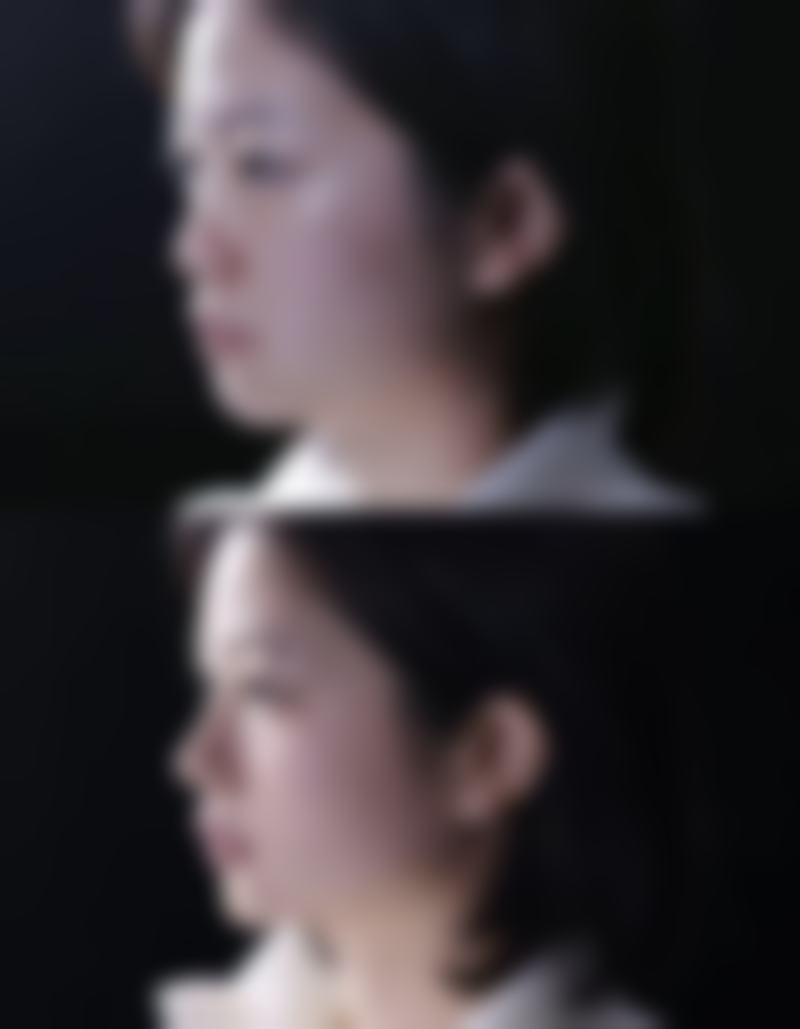 常见的医美方案有哪些,它们的适用情况、维持时间和修复期分别是怎样的?