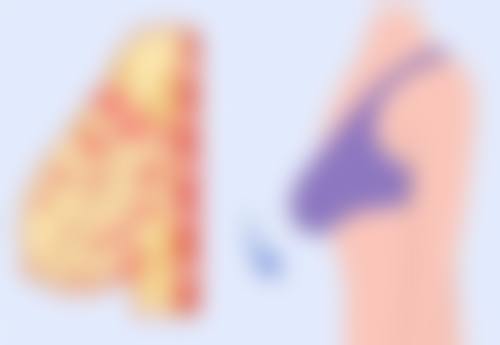 双眼皮做那种比较好看？平行、新月、欧式双眼皮，哪种更适合你的脸型？ 