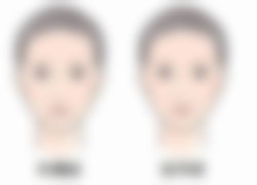 深圳新维医疗美容诊所正规吗？