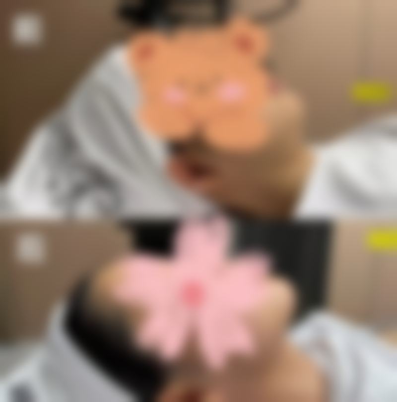 深圳和东莞有哪些可以做双眼皮手术的医院？