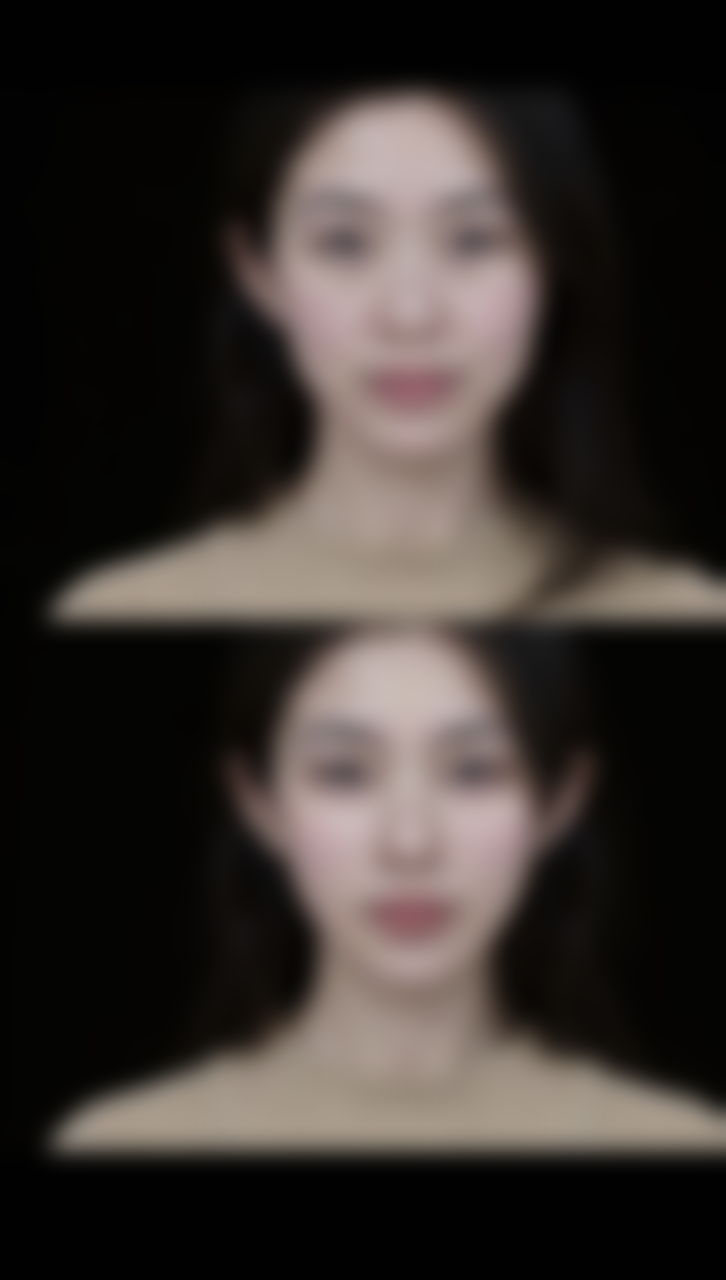 不同风格的人如何选择双眼皮？