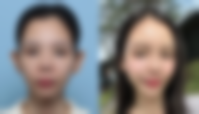 广东省第二人民医院(整形美容激光中 心)口碑评价怎么样?