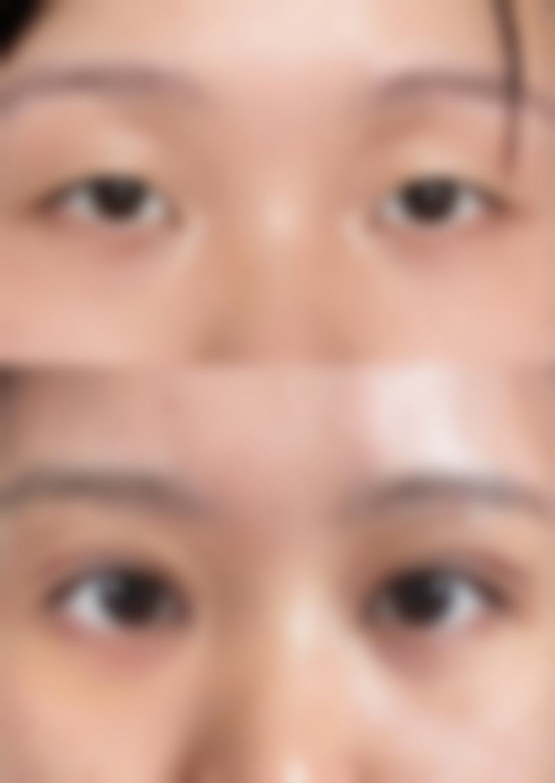 海口段碧辉医疗美容诊所正规吗？