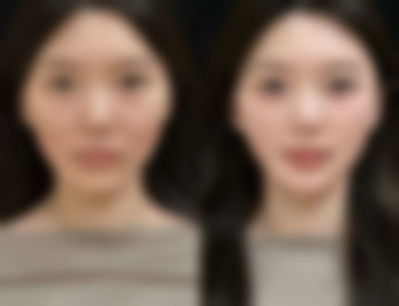 临汾莱灵创医疗美容诊所怎么预约