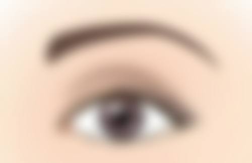 吸脂减肥总体修复期是多久？