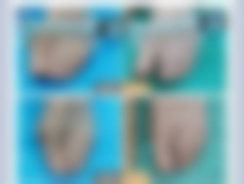 抚顺博爱整形医疗美容医院口碑评价怎么样？