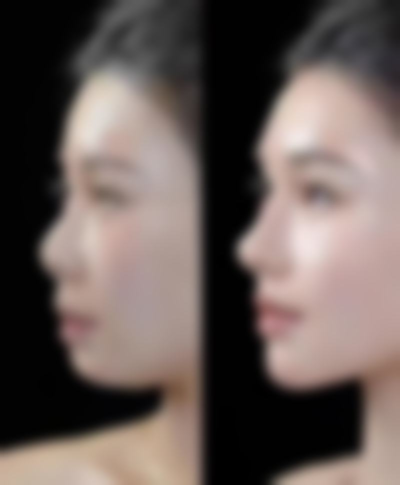 柳州格林美菲医疗美容门诊部口碑评价怎么样？