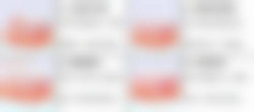 手术修复突出疤痕是怎样的呢？