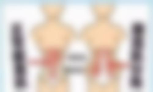 隆胸使用的假体取出后会有剧烈疼痛吗？