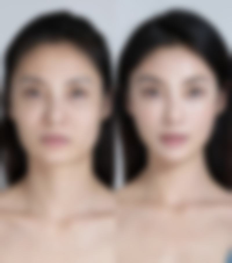 除了抹芦荟，还有哪些科学祛疤的方法？