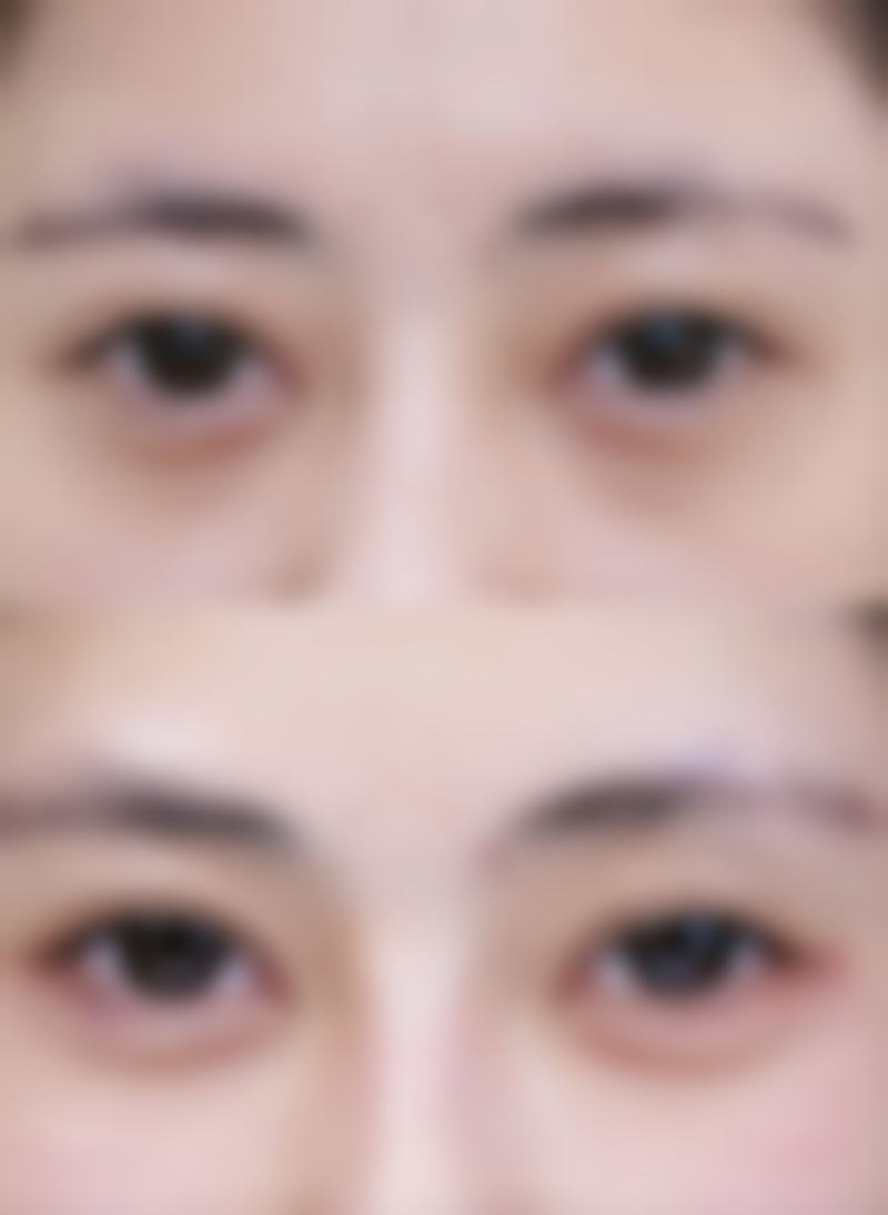 分阶段操作有哪些优势呢？