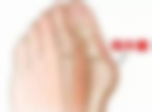 去医院后,有哪些医疗手段可以缓解疤痕痒呢?