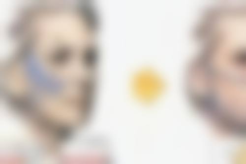 大腿抽脂后走路对修复有什么影响？