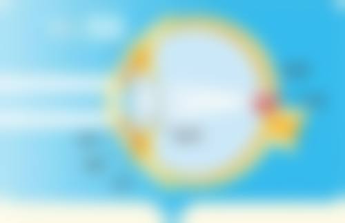 大腿抽脂后不同阶段对走路有什么要求？