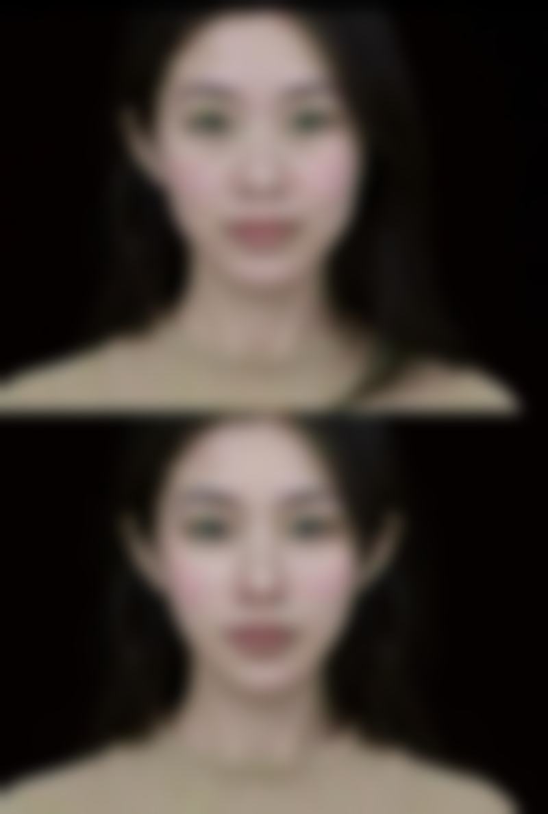 孝感仁爱医院美容整形中 心怎么预约