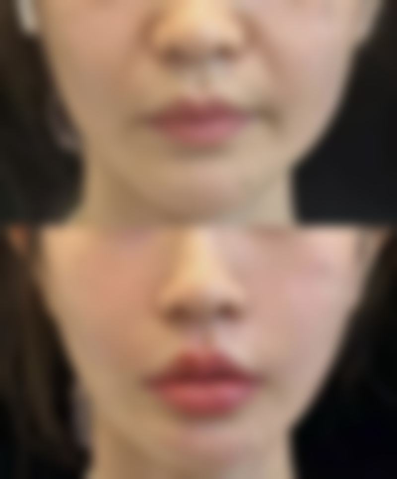 杭州韩佳医疗整形门诊部正规吗？