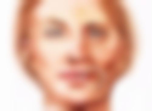 激光治疗疤痕小疙瘩成效如何呢？