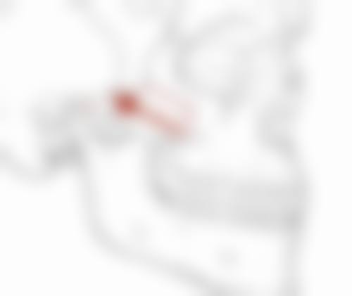 日常调理对去除酱油疤痕有帮助吗？