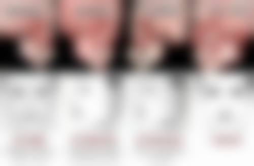 药物治疗疤痕小疙瘩具体是怎样的呢？