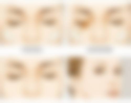 去医院做修复手术要注意些什么呢?