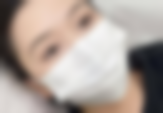 深圳吕瑛医生做双眼皮有什么独特之处?成效好在哪?