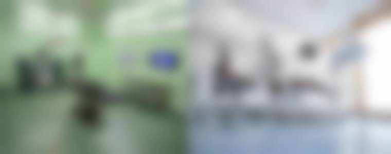 北京圣嘉新医疗美容医院飞顿冰点腋下脱毛用的是什么产品和技术？