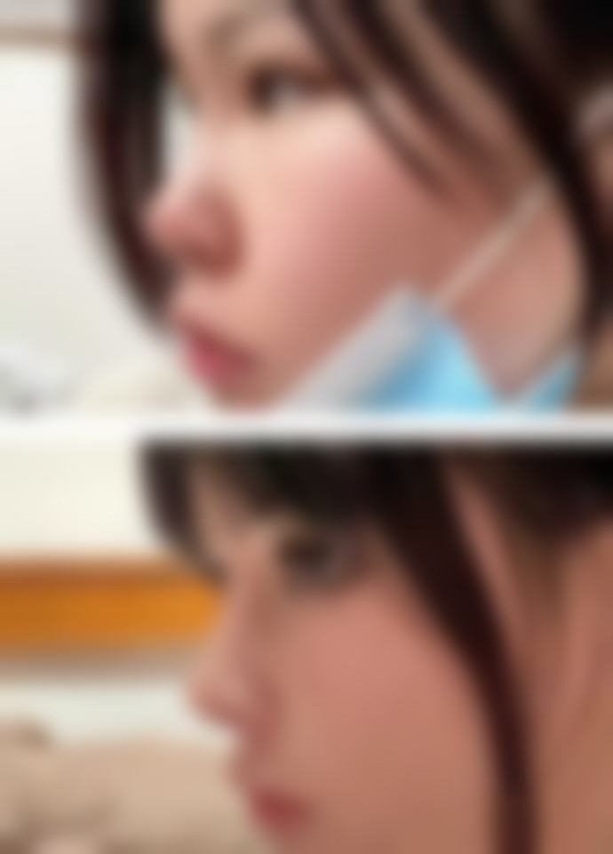 南阳维多利亚整形美容医院正规吗？