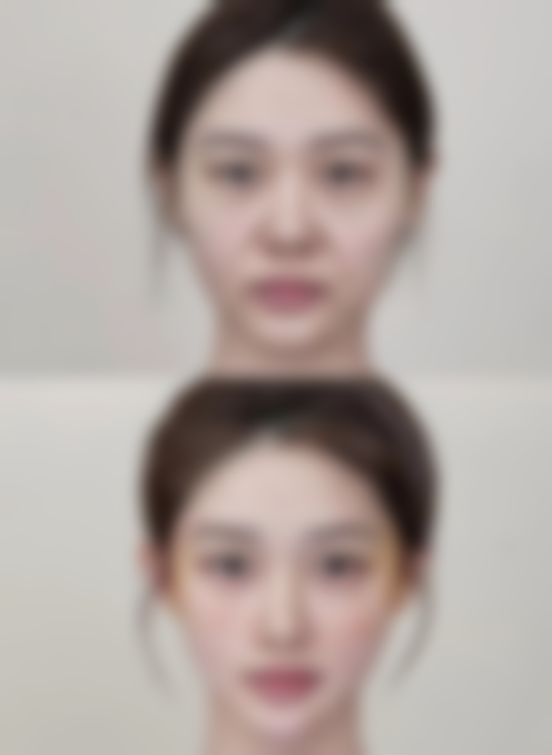 物理治疗疤痕小疙瘩包含哪些方法呢？