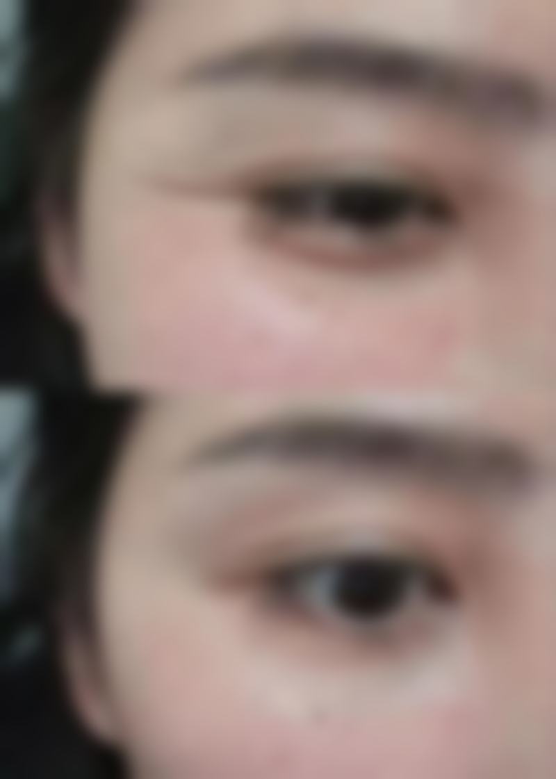 出现哪些症状表现需要建议就医，又有什么对应处理方式呢？