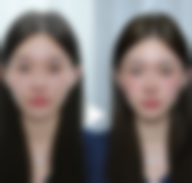 哪些因素会影响纳米无痕双眼皮的疼痛感知？