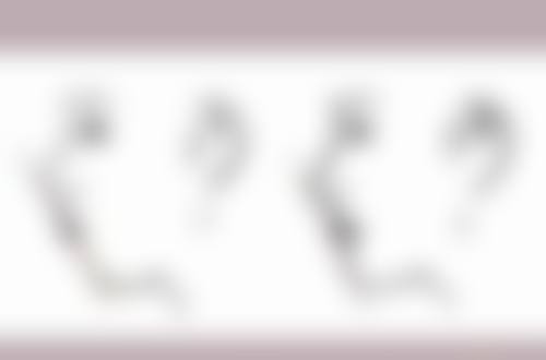 非手术类方案对消除眼袋有多大作用?