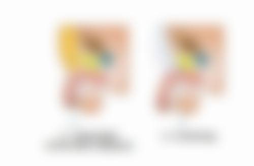 咸宁安美医疗美容门诊部邹红医生眼部整形技术怎么样？