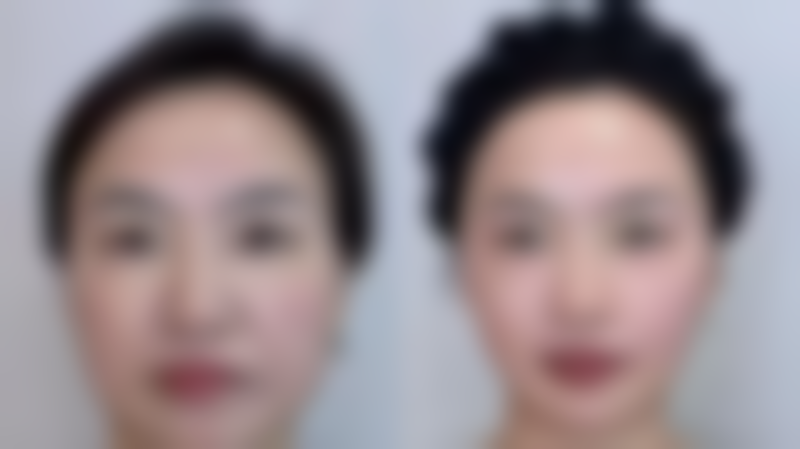 西安艺朵脂美人医疗美容医院怎么预约