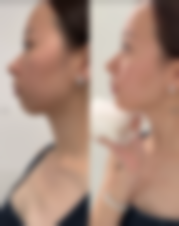 有哪些可能影响哺乳的因素，又该怎么应对呢？