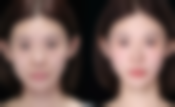 隆胸术后哺乳时要怎么护理和应对可能出现的问题呢？