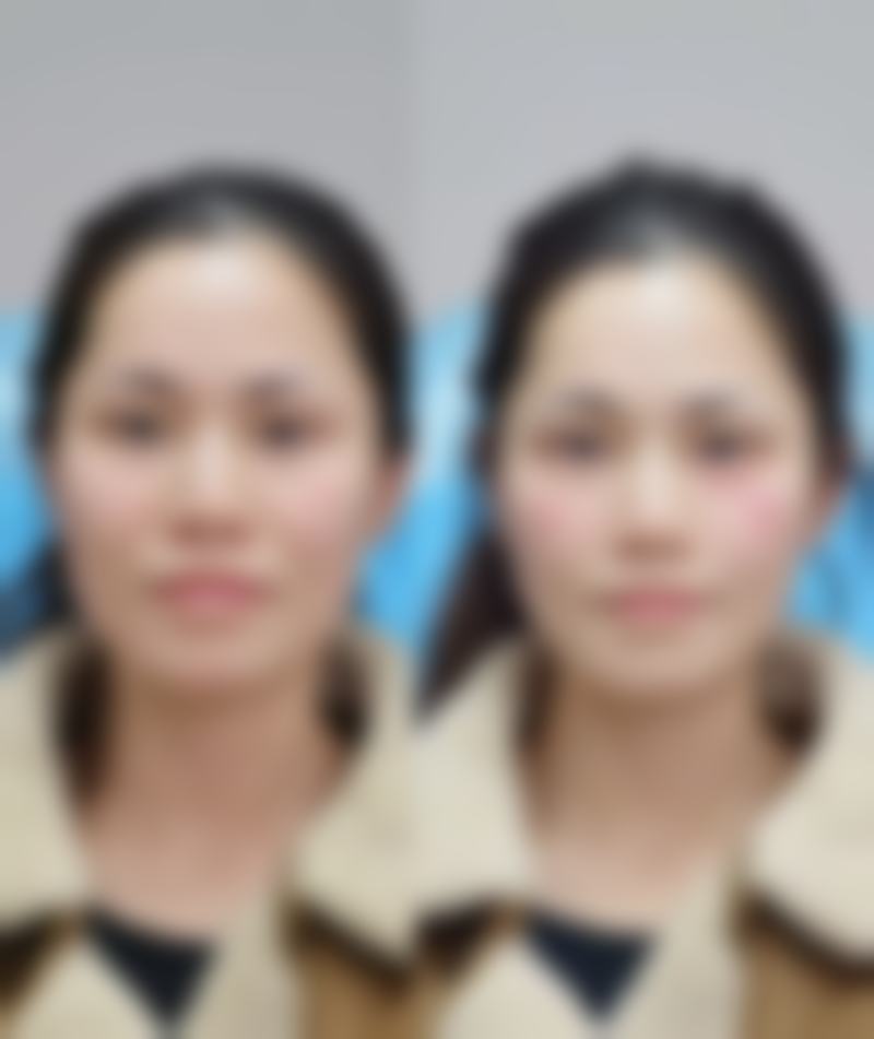 沈阳瑞利佳澜整形医院怎么预约