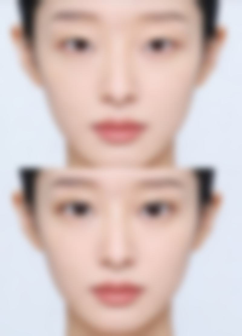 除了上述方法,还有哪些常见治疗方式?