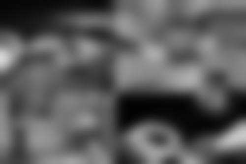 整双眼皮会留疤吗？选对方法、做好护理，多数情况下可避免留明显疤痕！ 