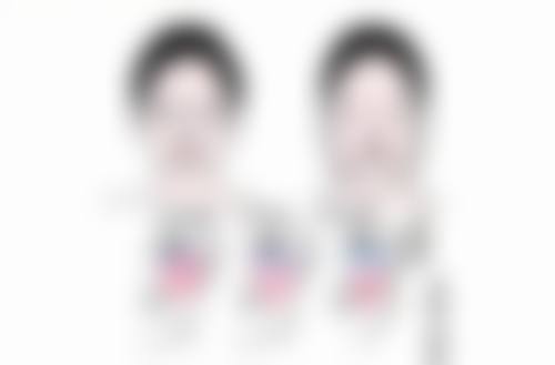 假体隆鼻需要多长时间呢？