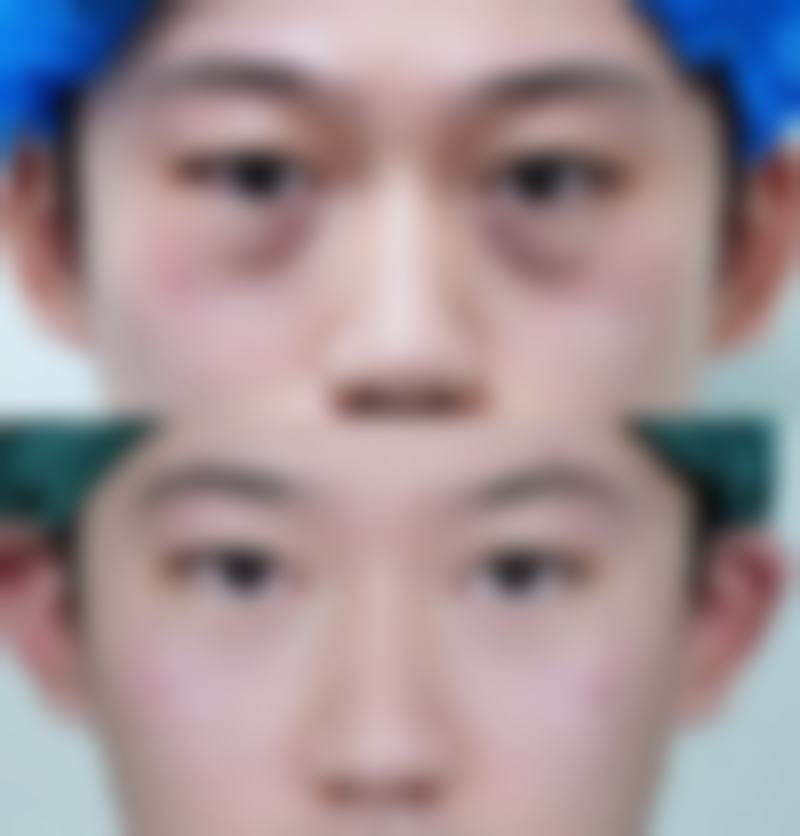 厦门174医院整形美容科郭志谦医生皮肤美容技术怎么样？