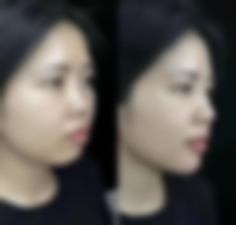 医院所在地区经济水平对头发种植费用有什么影响呢?