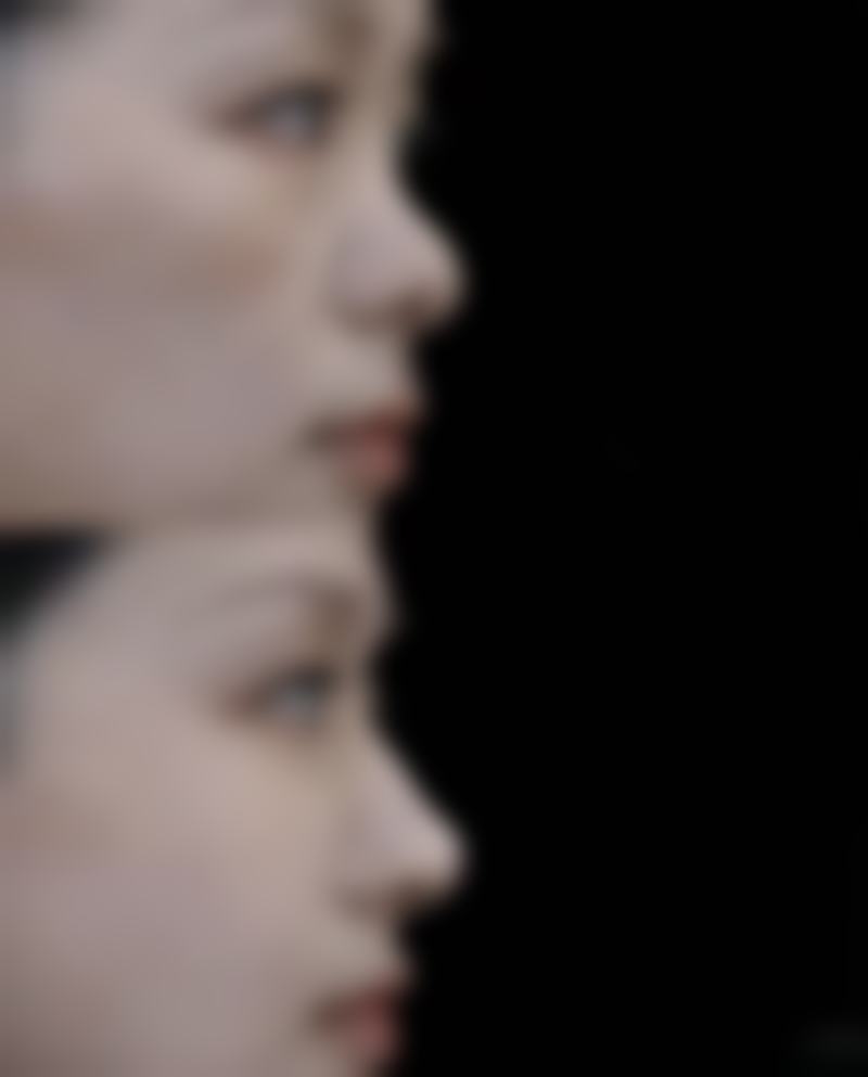 有哪些常见的修复十几年凸起疤痕的方法及原理？