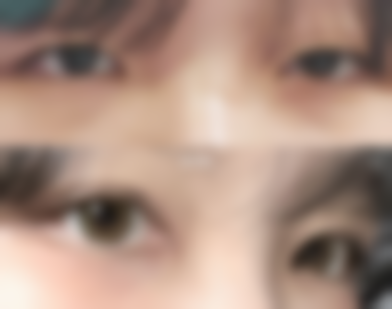 重庆第二人民医院烧伤整形科正规吗？