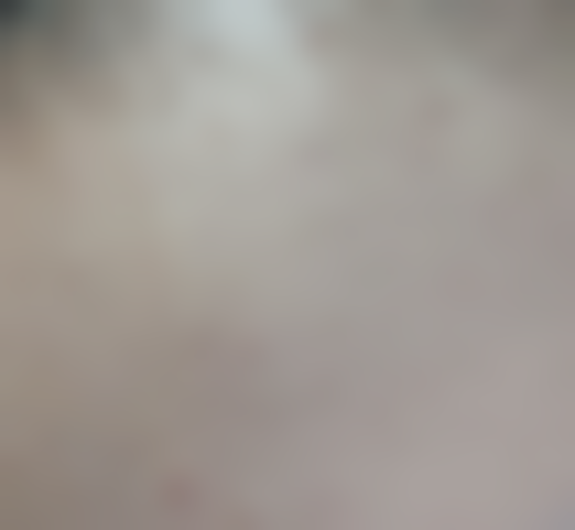 成都华美紫馨医学美容医院植发分享：术后三月成效渐显，期待早日摆脱刘海束缚，未来有什么期待呢？