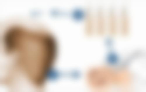 不同来源对于假体更换有什么建议呢?